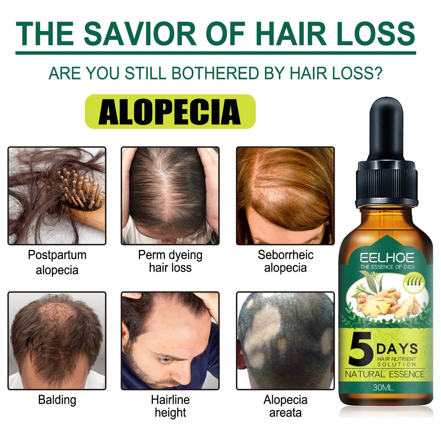 Eelhoe Ginger Hair Essential Oil. Eelhoe Ginger Hair Essential Oil - image 3