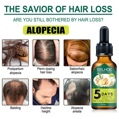 Eelhoe Ginger Hair Essential Oil. Eelhoe Ginger Hair Essential Oil - image 3
