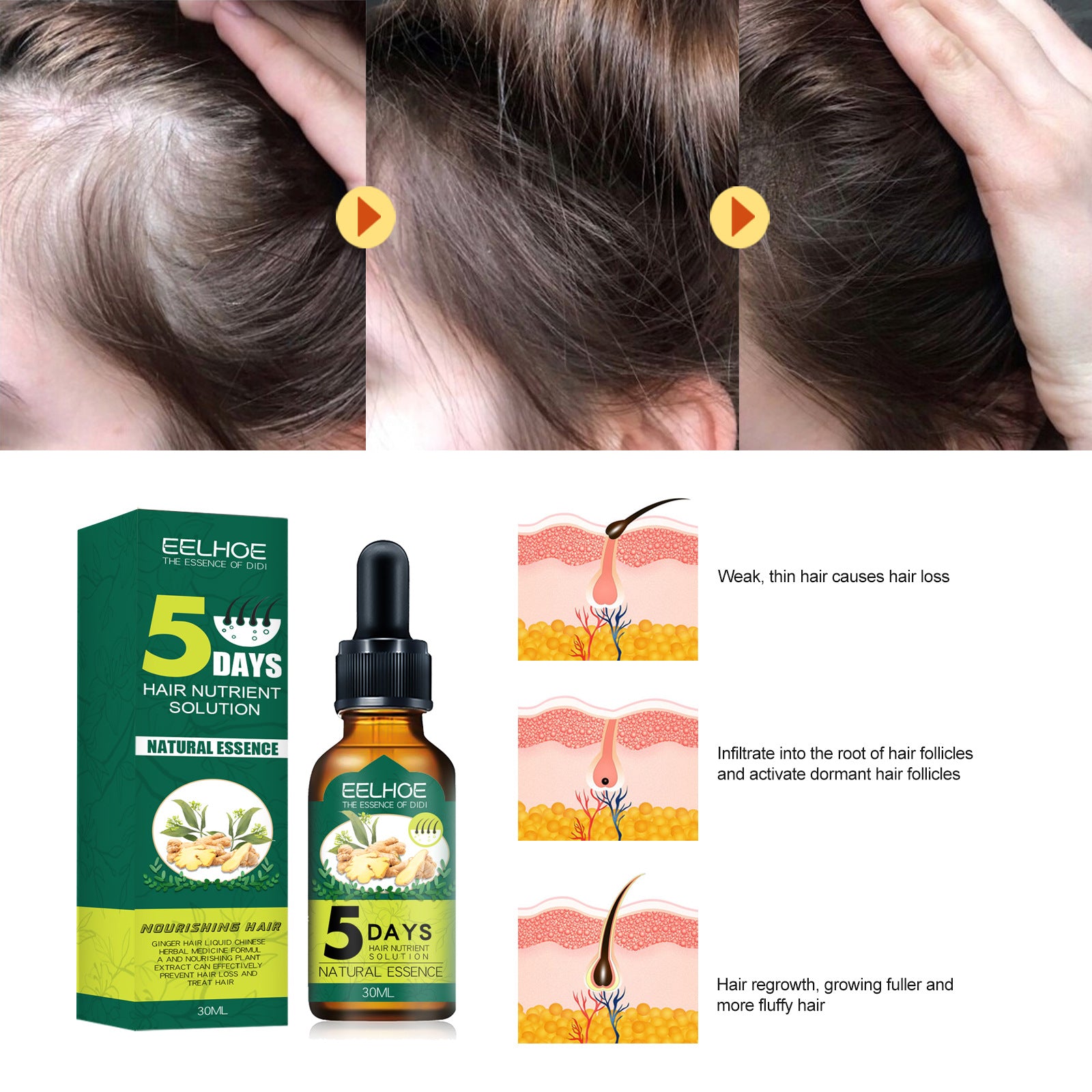 Eelhoe Ginger Hair Essential Oil. Eelhoe Ginger Hair Essential Oil - image 4