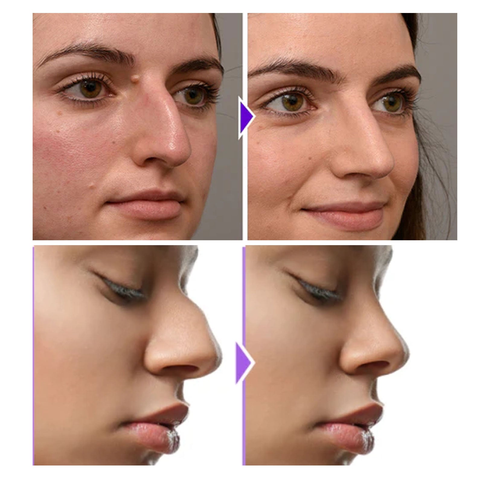 Eelhoe Nose Shaper Nose Shape Shaper Nose Shape Shaper Nose Shape Shaper Nose Shape Shaper - image 2